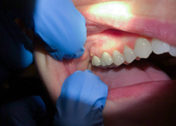 Best Pediatric Emergency Dentist in Windsor, NC